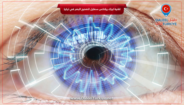 تقنية ليزك ريلاكس سمايل لتصحيح البصر في تركيا