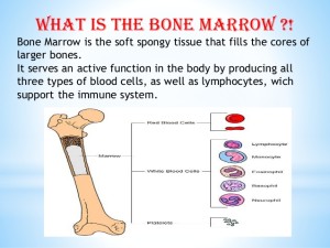 Bone marrow transplant