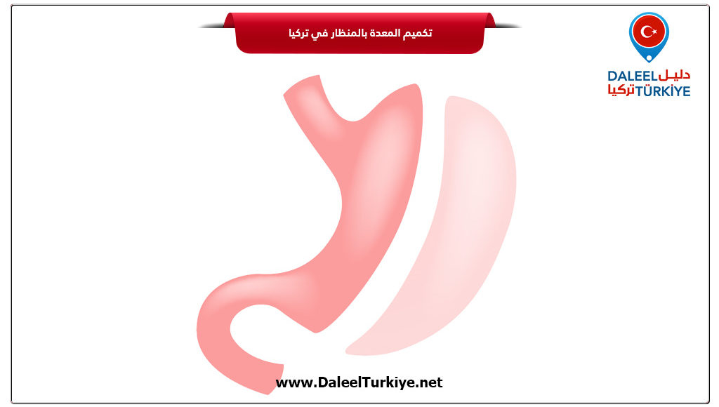 تكميم المعدة بالمنظار في تركيا