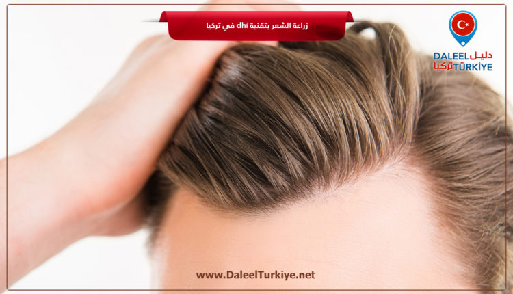 زراعة الشعر بتقنية DHI في تركيا