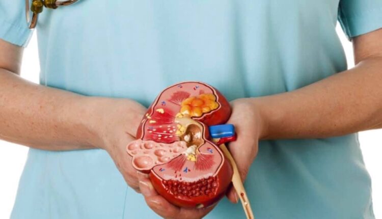 باحثون يبتكرون كلية اصطناعية