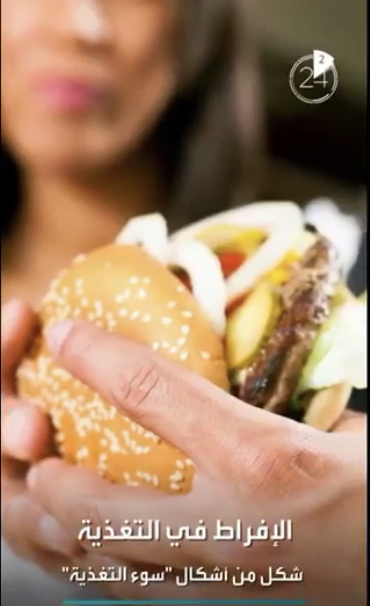 الافراط في التغذية شكل من أشكال سوء التفذية