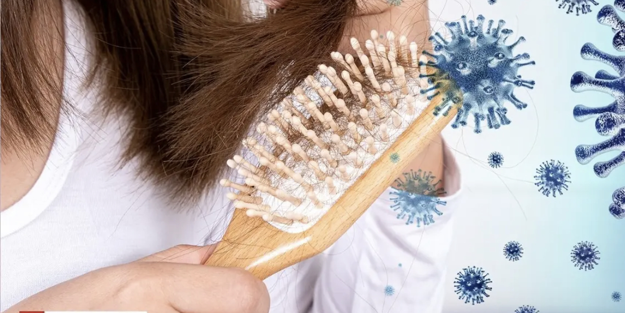ووفقًا لجمعية الأكاديمية الأميركية للأمراض الجلدية، فإن تساقط الشعر هو عرض شائع بعد الإصابة بكوفيد-19