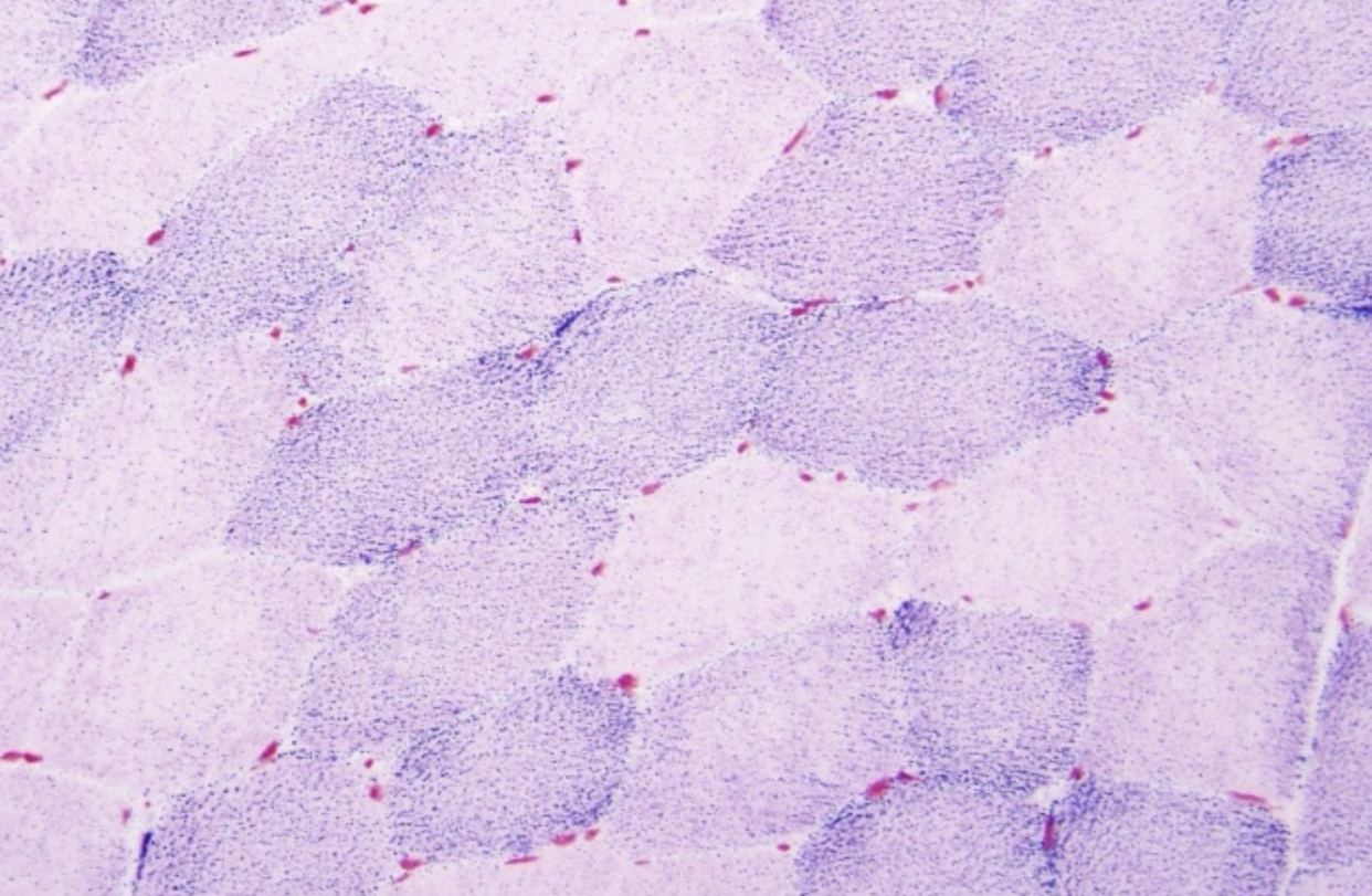 الاستنساخ العلاجي لإصلاح أمراض الميتوكوندريا