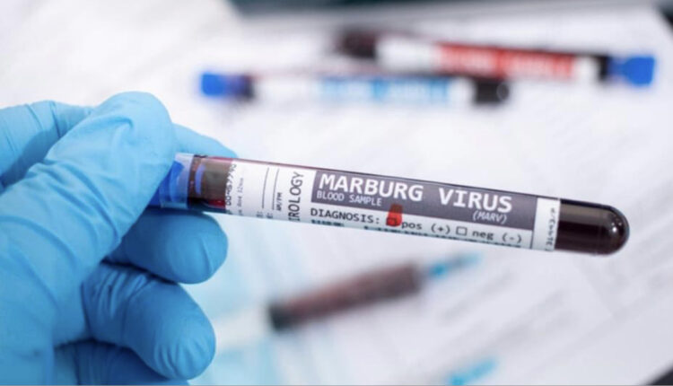 صداع وحمى شديدة.. ماذا نعرف عن فيروس ماربورغ؟   أثار تسجيل إصابات بفيروس ماربورغ في غانا بإفريقيا المخاوف حول العالم، بعدما أعلنت منظمة الصحة العالمية أول تفش له هناك، حيث سجلت أول وفاتين بعد إصابتهما بالعدوى. لكن ماذا نعرف عن هذا الفيروس الشبيه بفيروس إيبولا؟ لا سيما وجود احتمال أن يكون ضاراً للغاية ومميتا، حيث تراوح معدل الوفيات في حالات التفشي السابقة بين 24% و88%.   طريقة العدوى ونبدأ من طريقة انتقاله، فقد أكدت منظمة الصحة العالمية أن المرض وهو حمى نزفية شديدة العدوى من نفس عائلة الإيبولا ينتقل للبشر عبر خفافيش الفاكهة وينتقل بين الأشخاص بالاتصال المباشر بسوائل الجسم للأشخاص المصابين والأسطح. فيما يقتضي انتشاره بين البشر مخالطة أحد المصابين به عن كثب، إلا أنه لا يعدي بين البشر أثناء فترة حضانته.